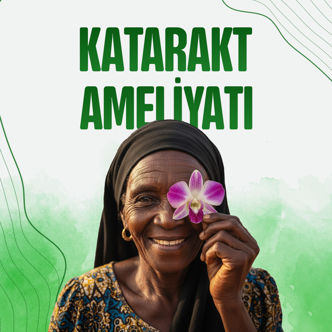 Katarakt Göz